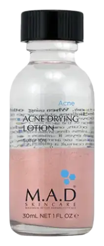 M.A.D Skincare Acne Drying Lotion