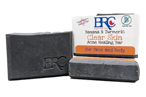 By Robin Creations Clear Skin Acne Healing Bar With Banana & Turmeric