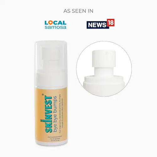 Skinvest Bye Bye Bumps