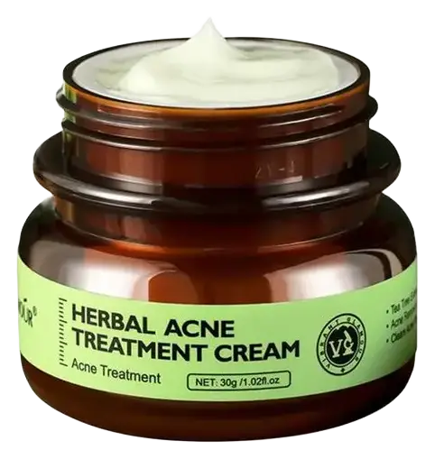 Vibrant Glamour Herbal Acne Treatment Cream