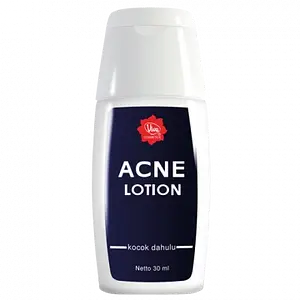 Viva Cosmetics Acne Lotion