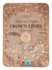 Frown Lines
