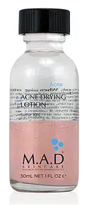 M.A.D Skincare Acne Drying Lotion